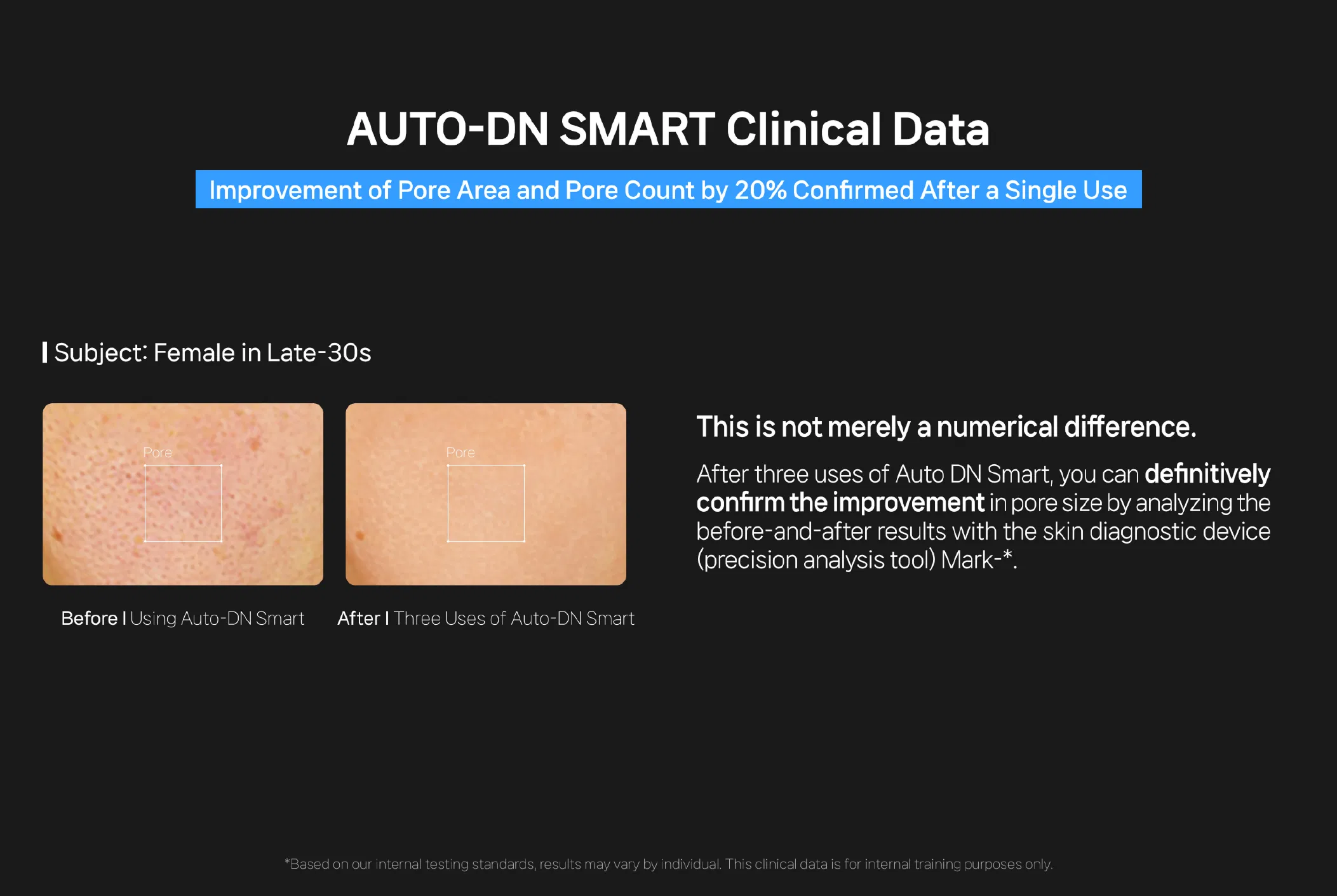 Auto-DN Smart · product information