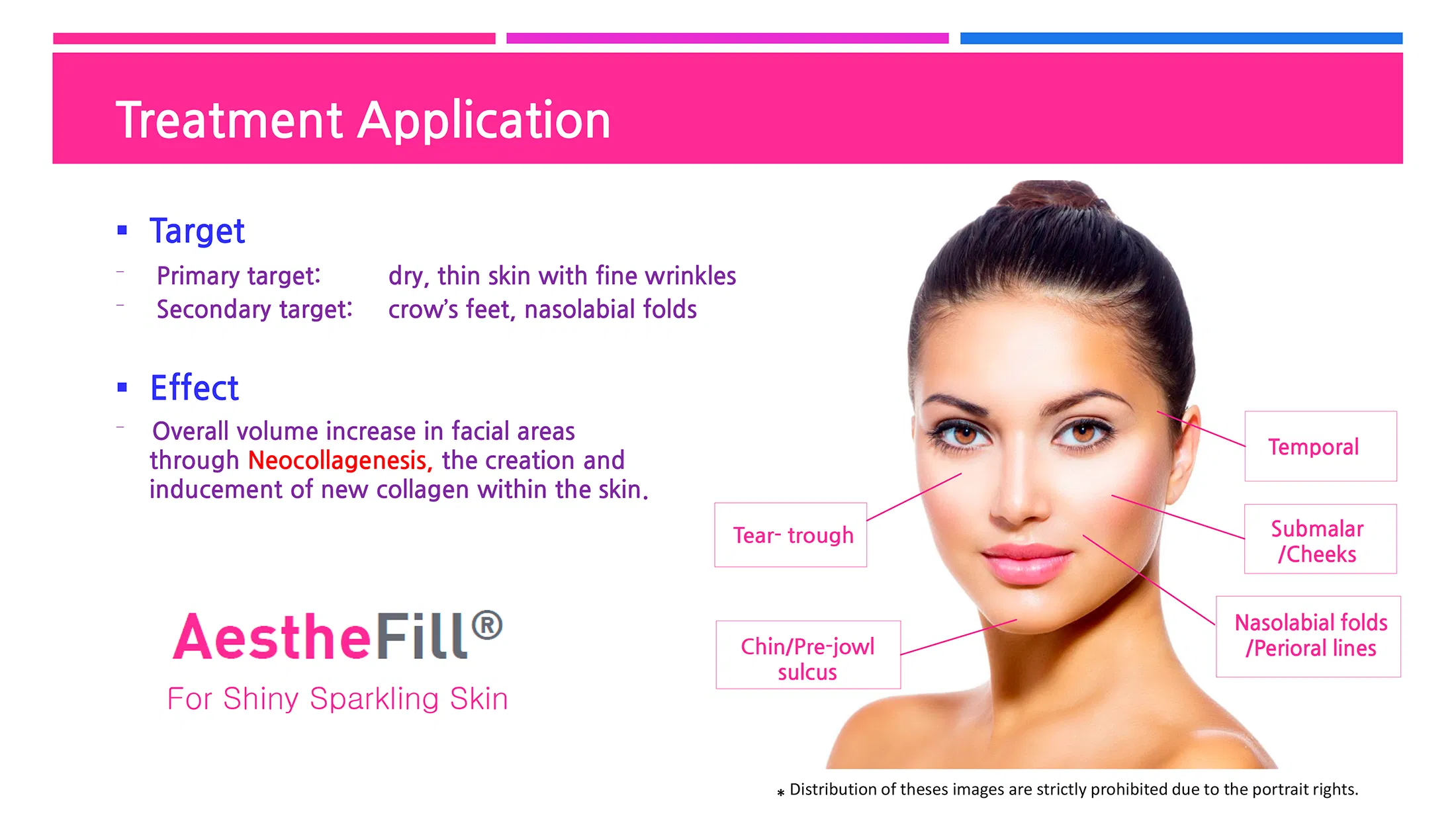 AestheFill · product information