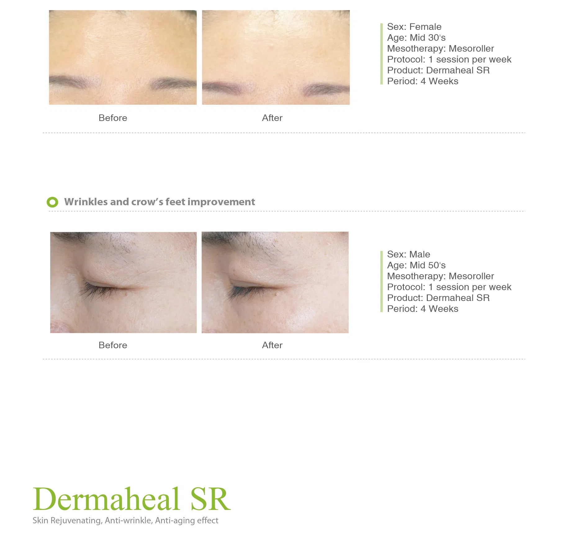 Dermaheal SR · product information