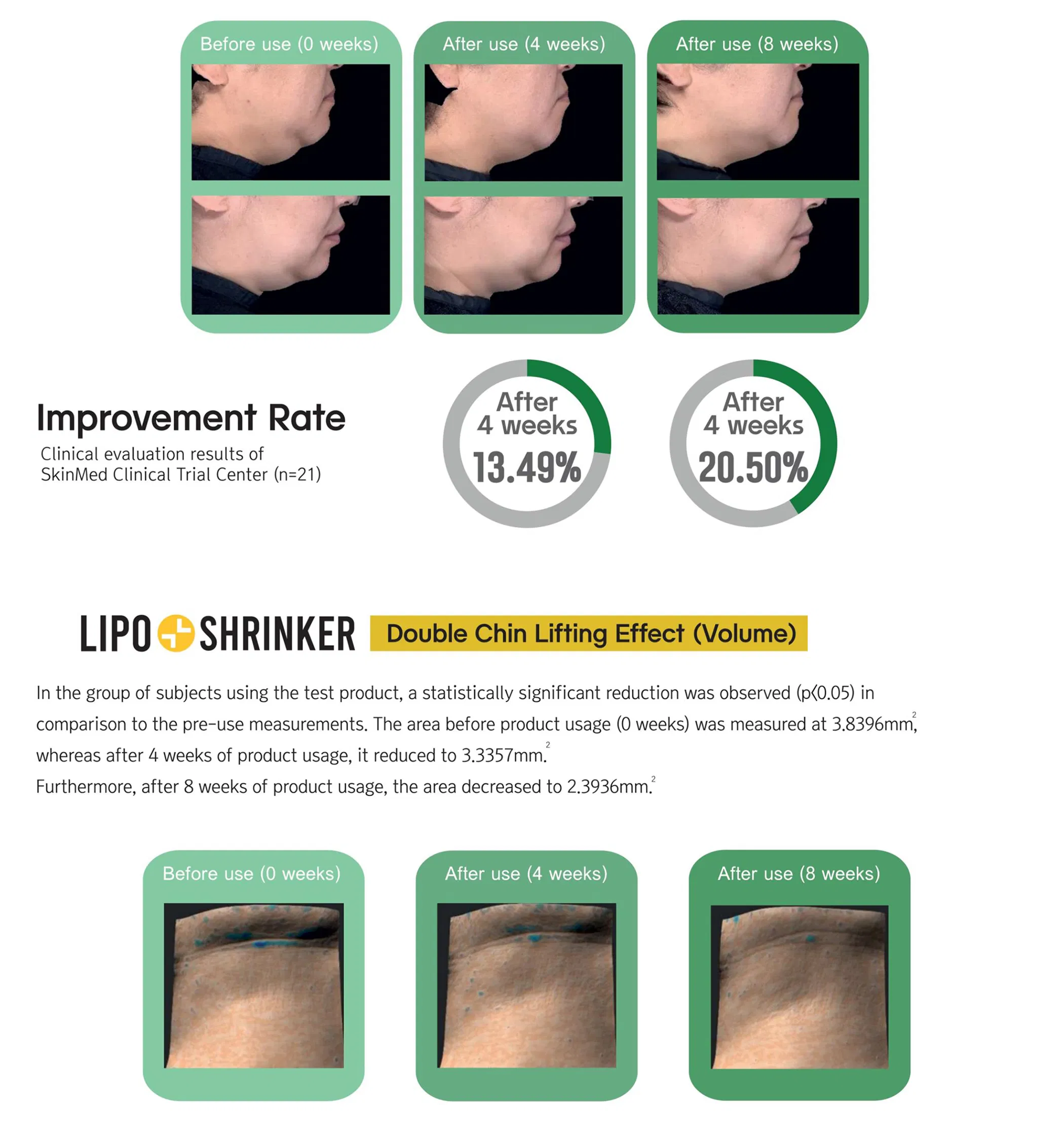 Lipo Shrinker (1 vial) · product information