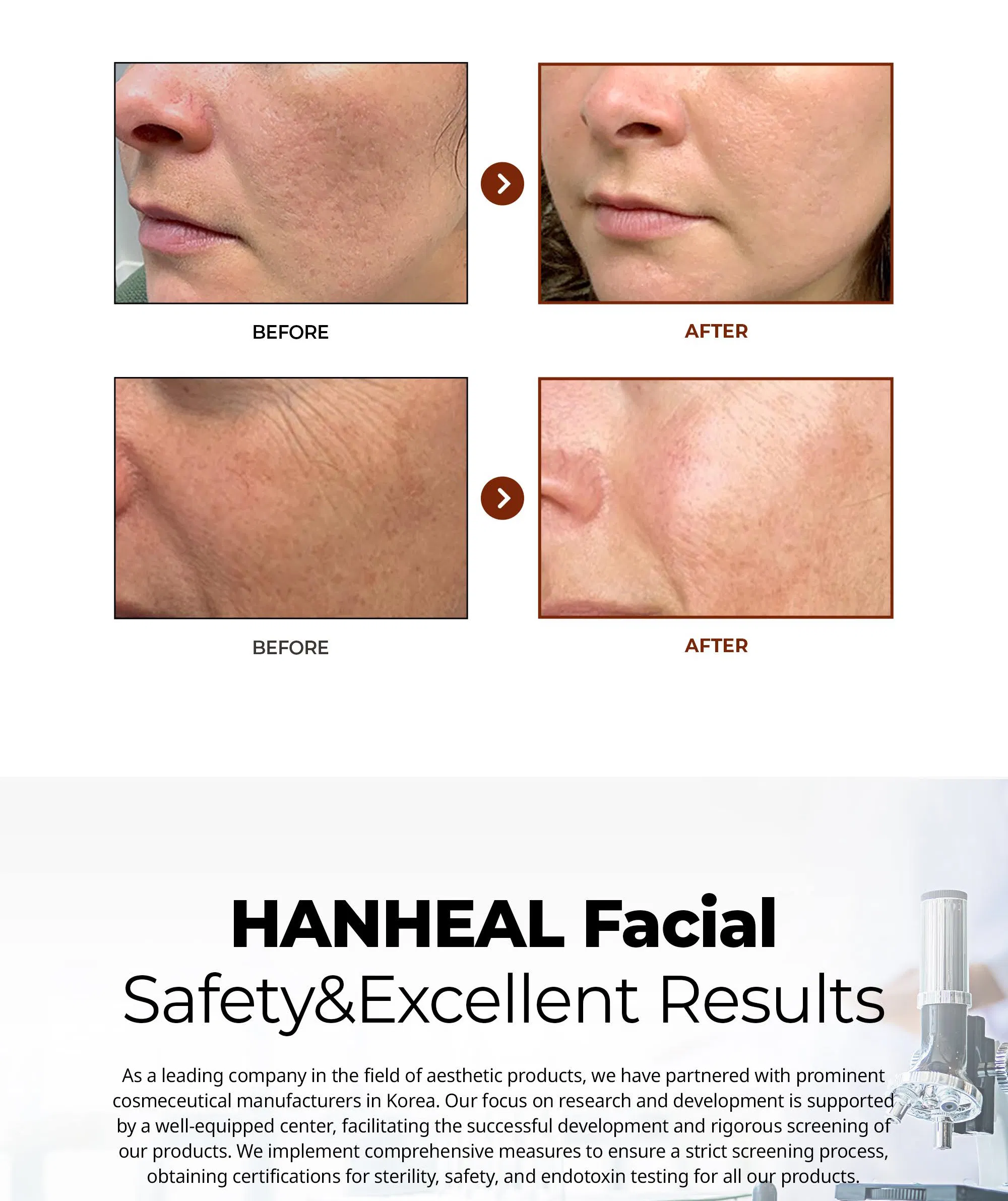 Hanheal Exosome Facial Rejuvenation · product information