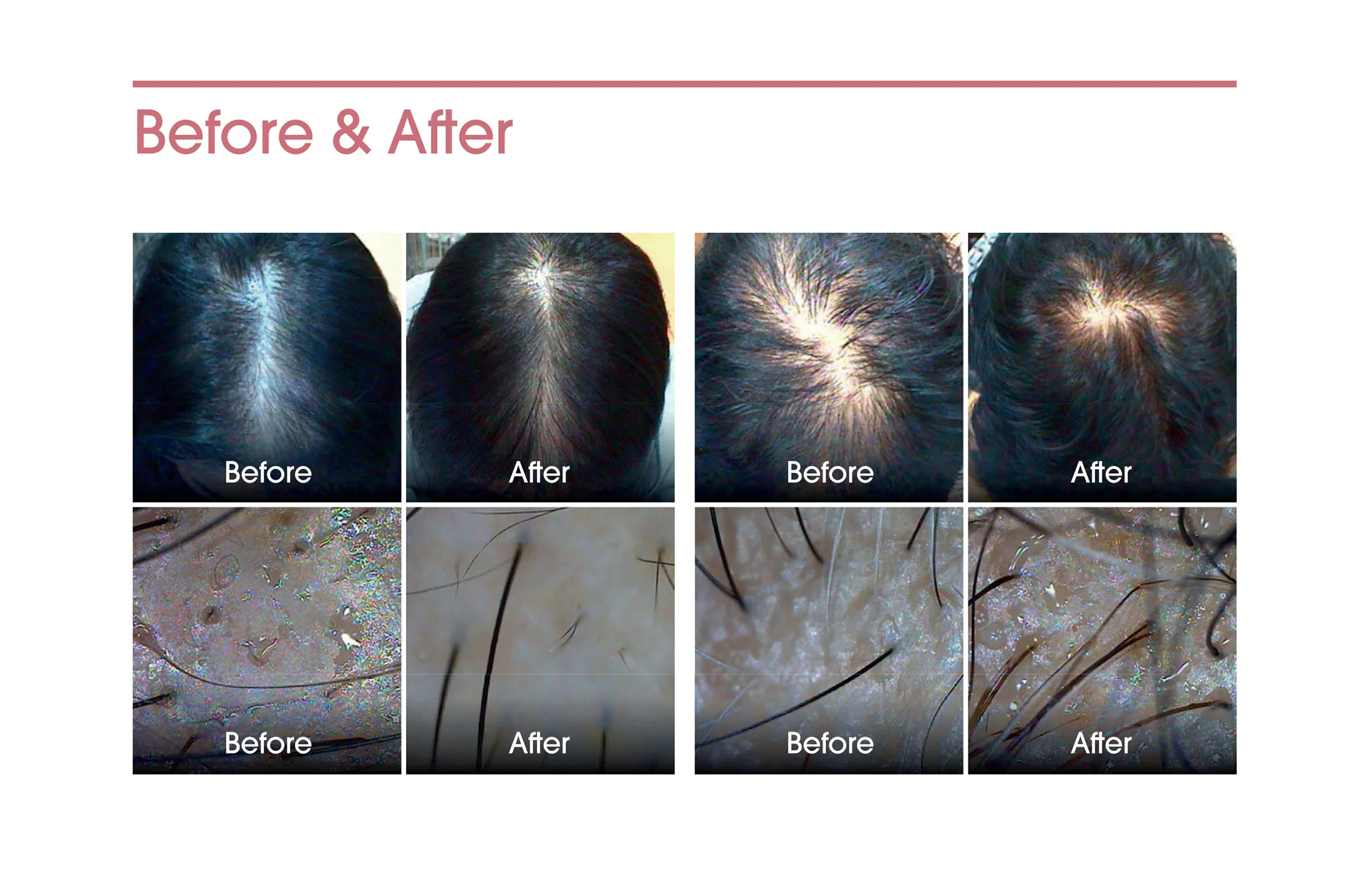 Exoxe Hair · product information