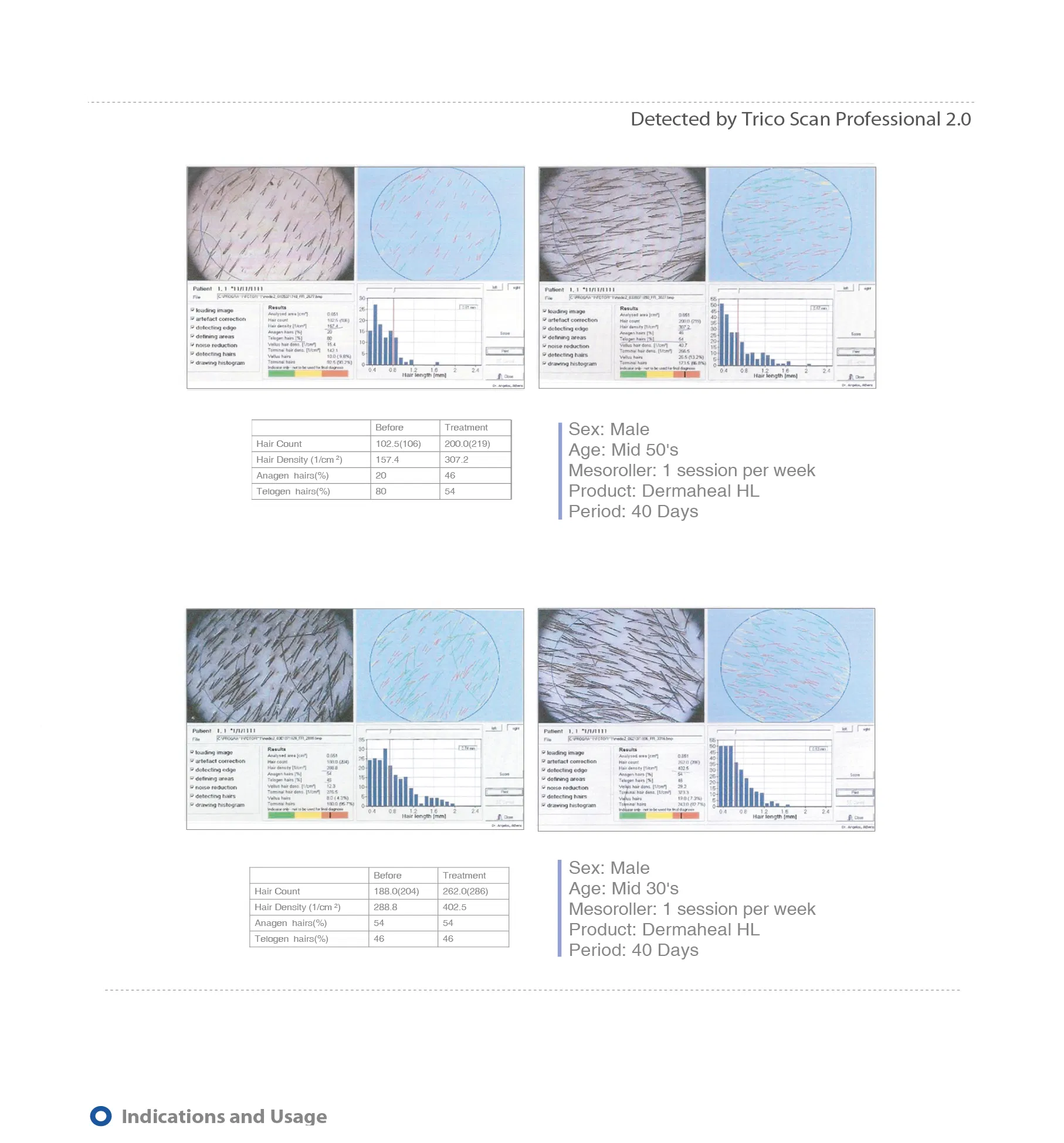 Dermaheal HL · product information