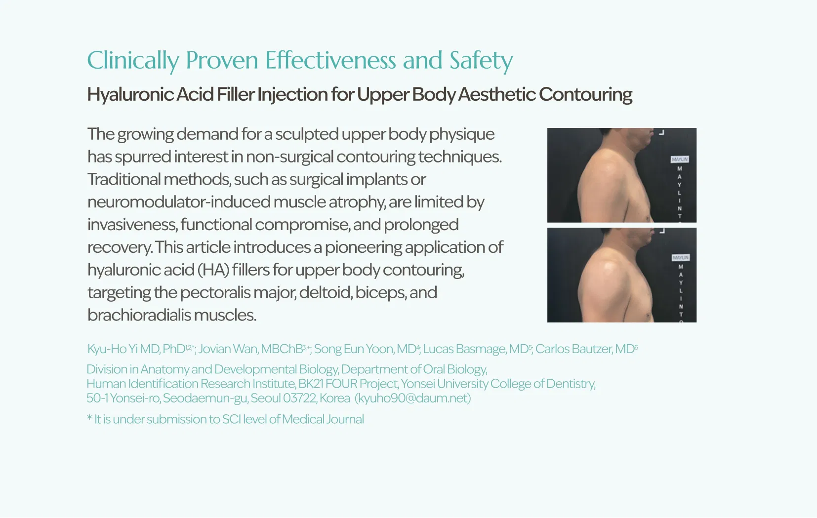Sedy Fill Body Filler 80ml · product information