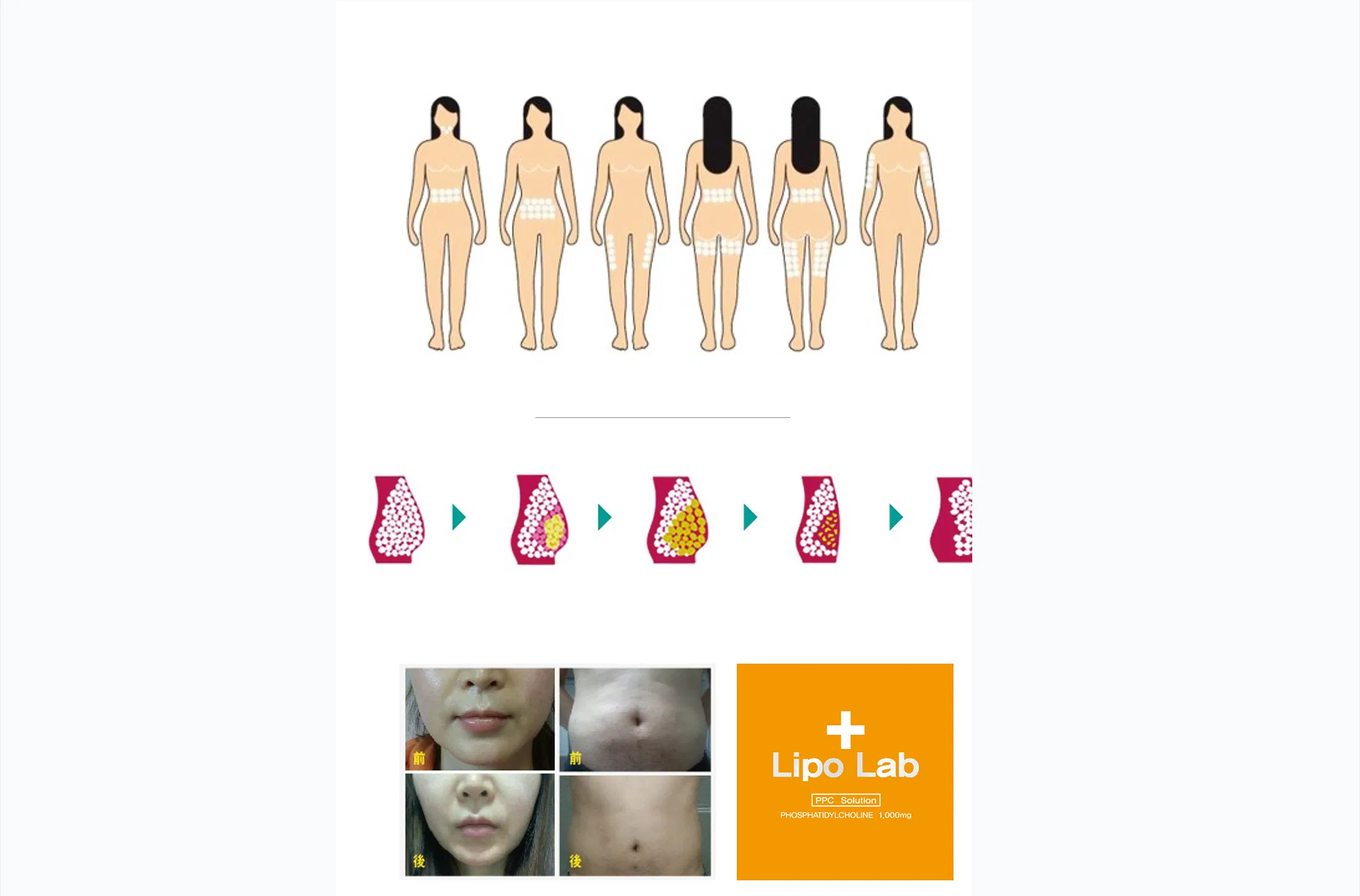 Lipo Lab PPC Solution · product information