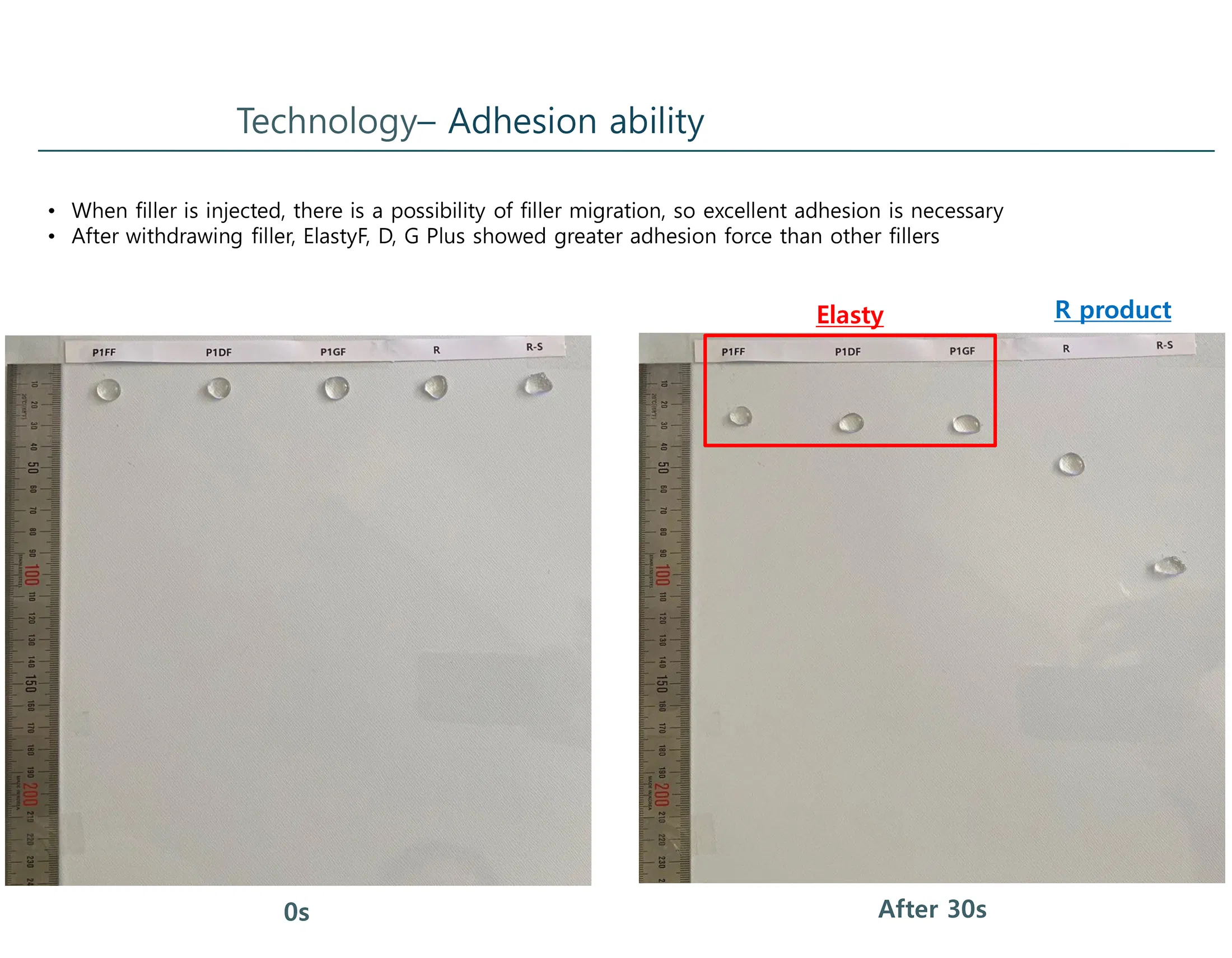 Elasty D Plus (2 syringes) · product information