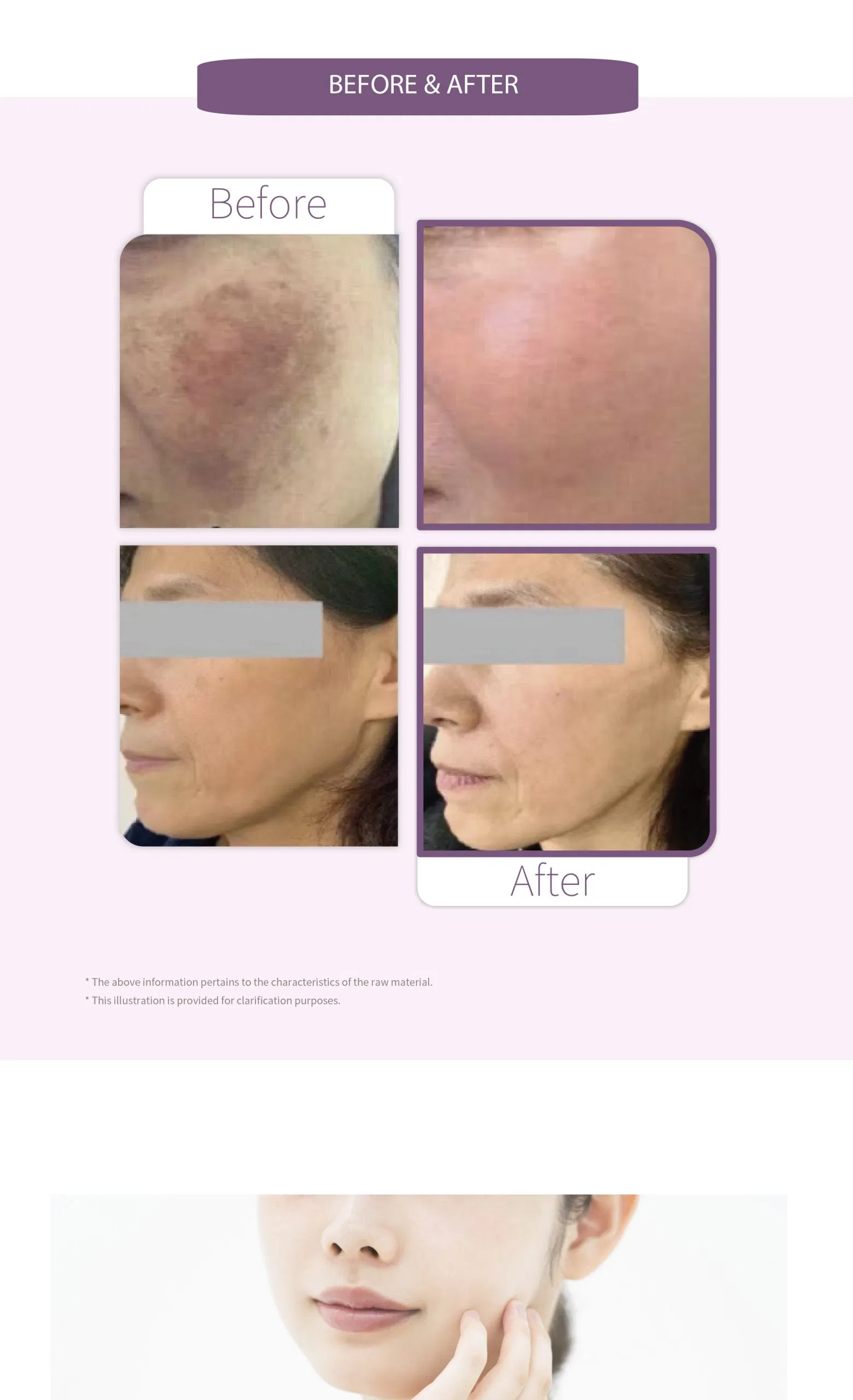 GTM Exomela · product information