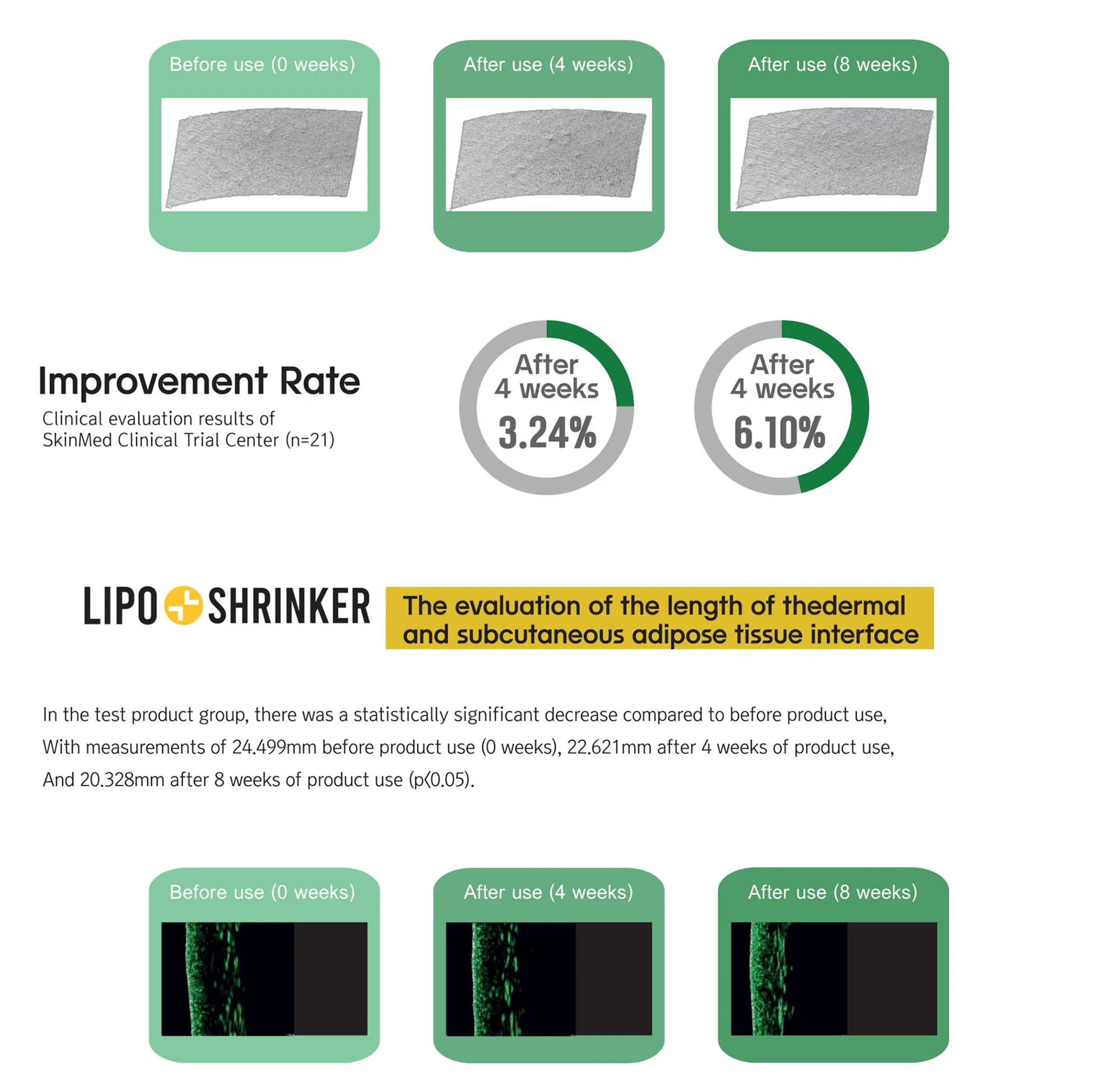 Lipo Shrinker (1 vial) · product information