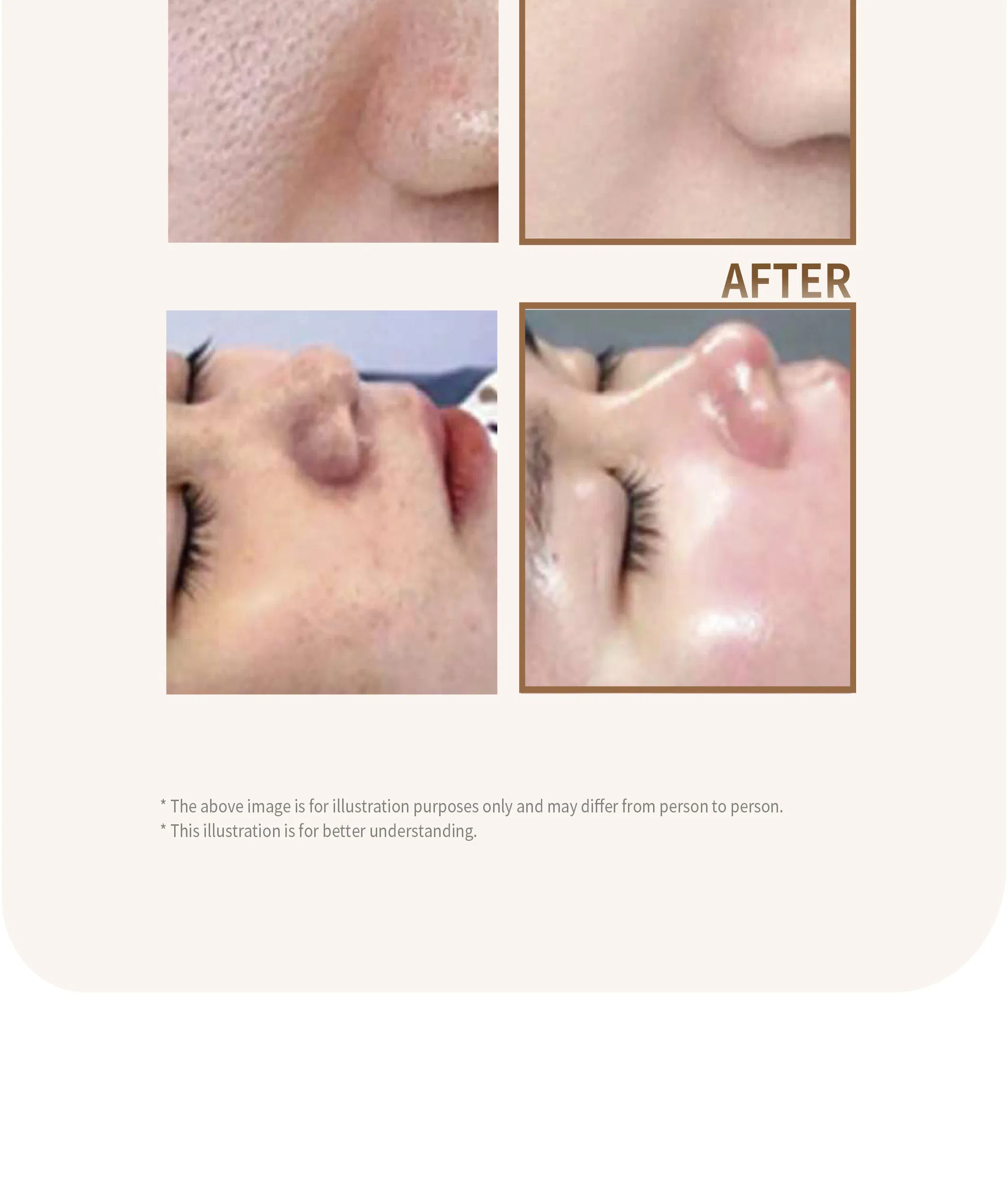 GTM Goldcell 8% · product information