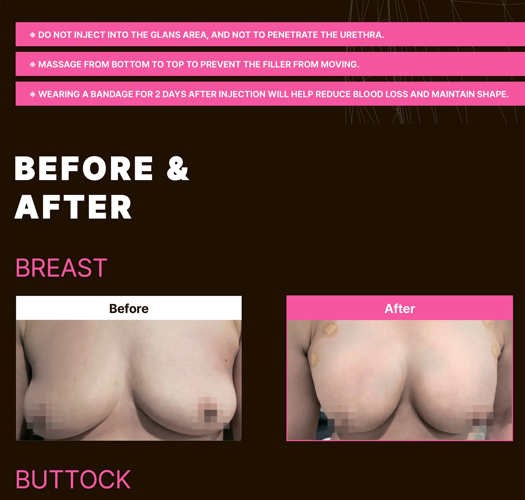 Maxy Fill Body Filler 70 ml · product information