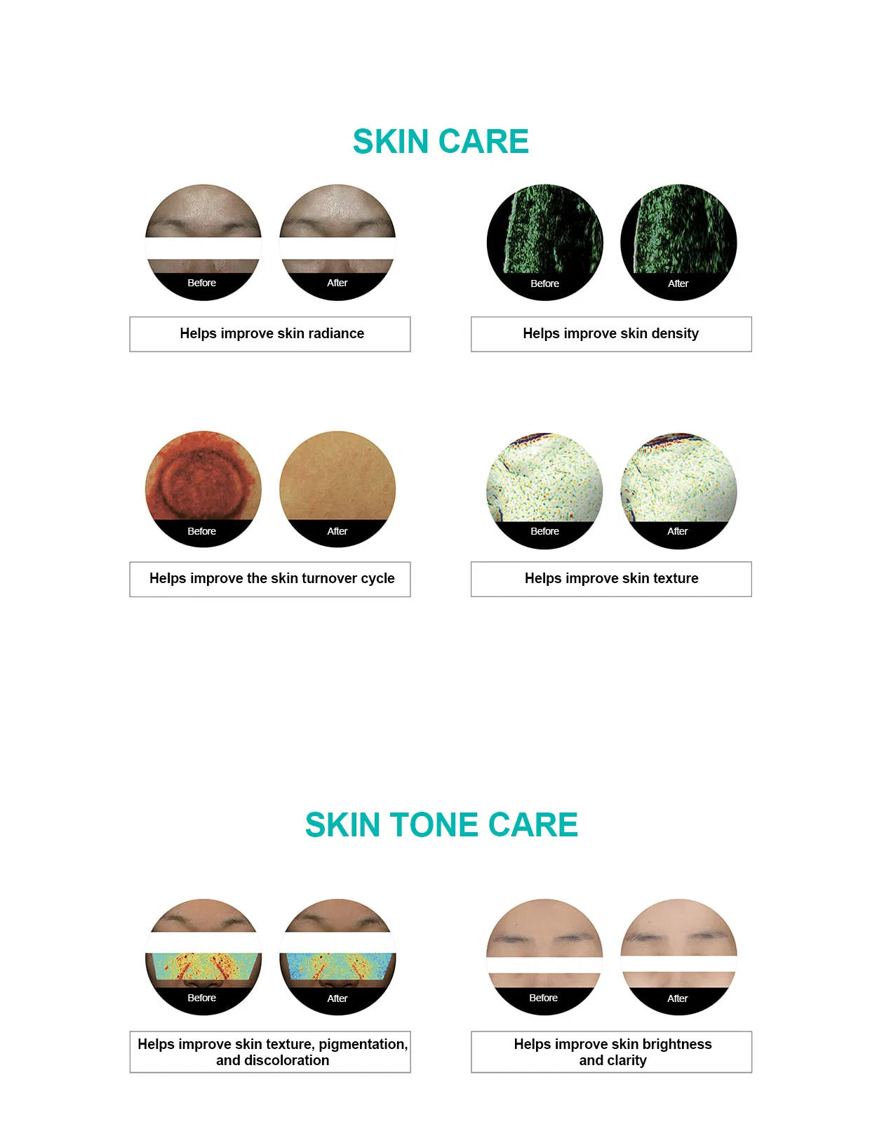 Rejuran Turnover Ampoule · información del producto