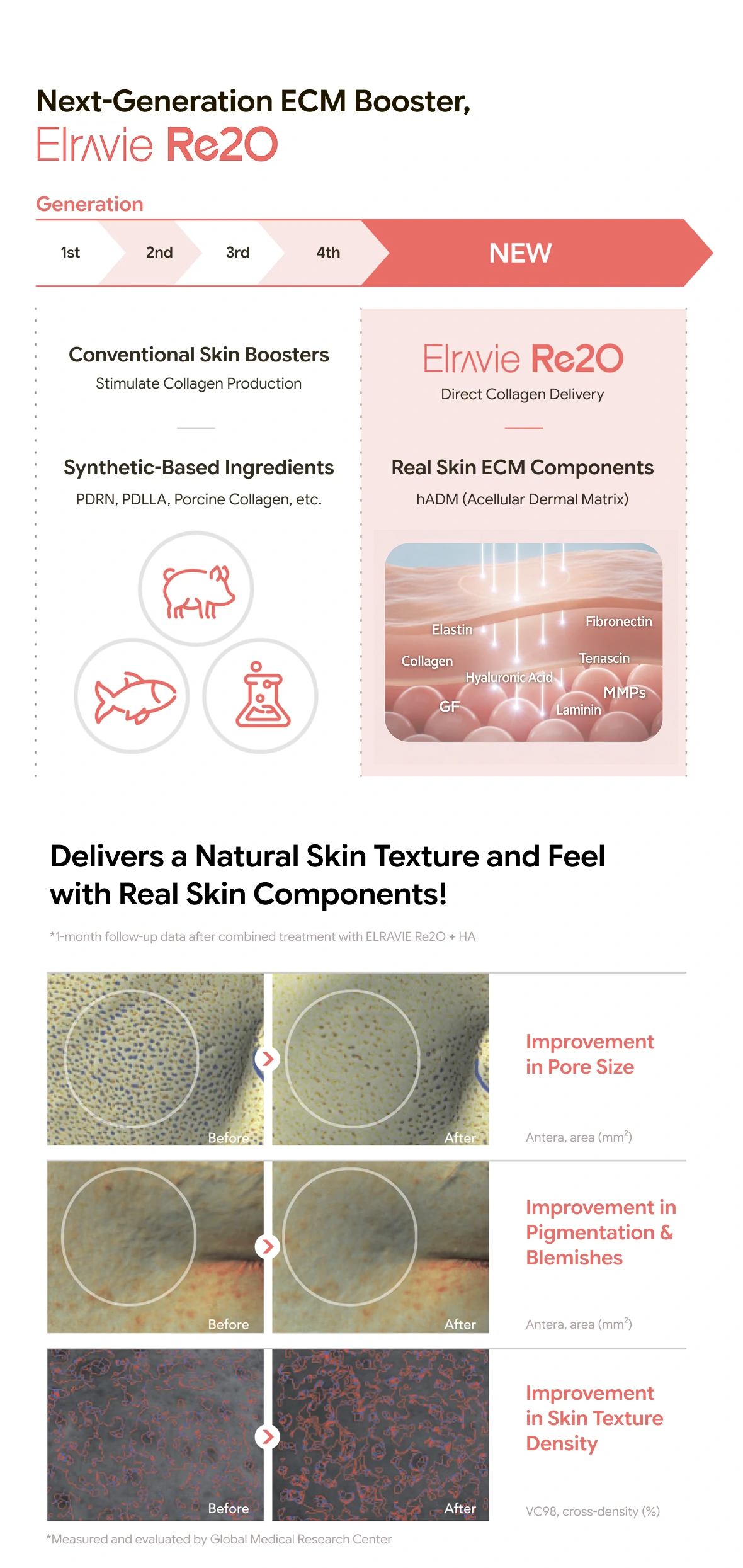 RE2O · product information