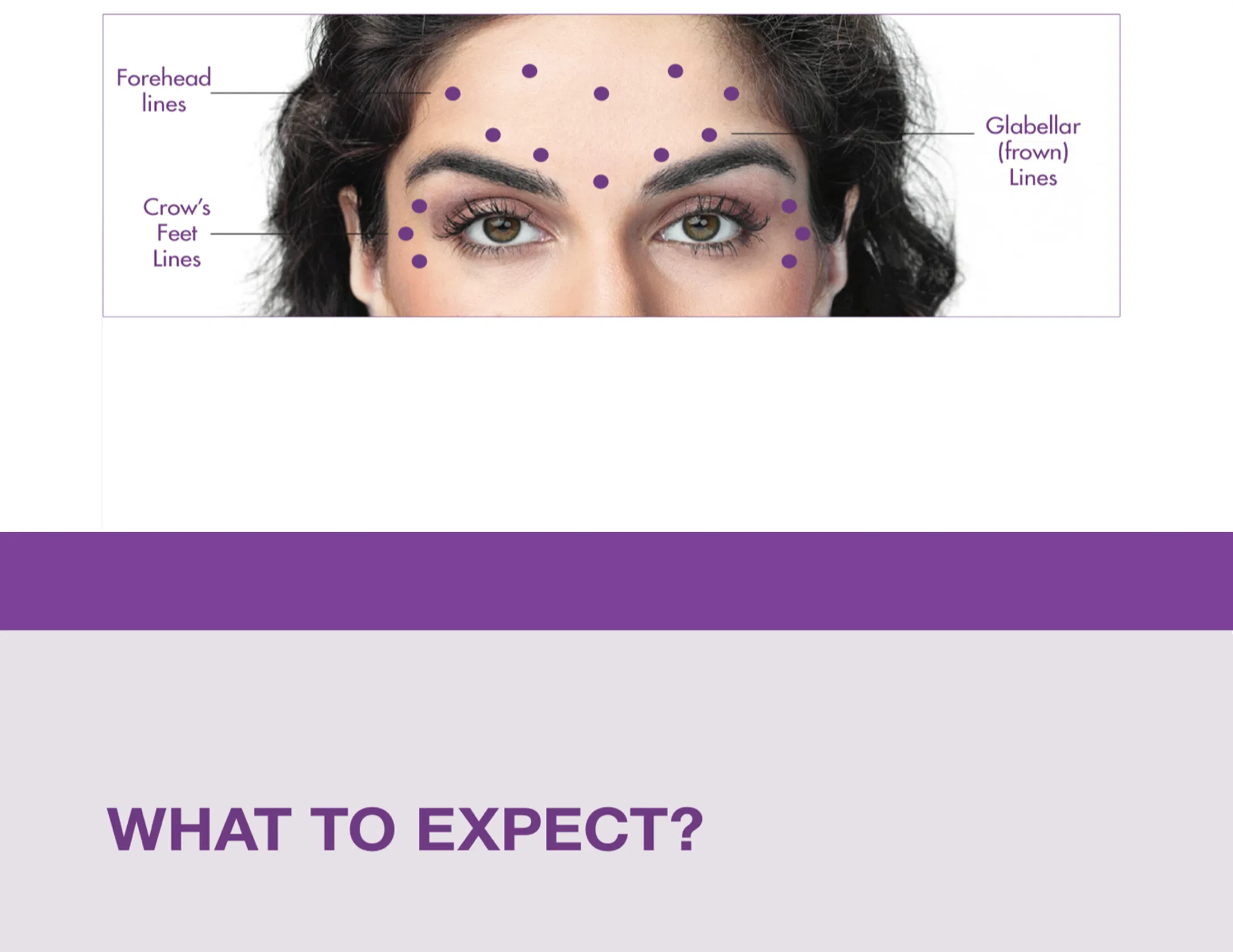 Botox 50 unidades · información del producto