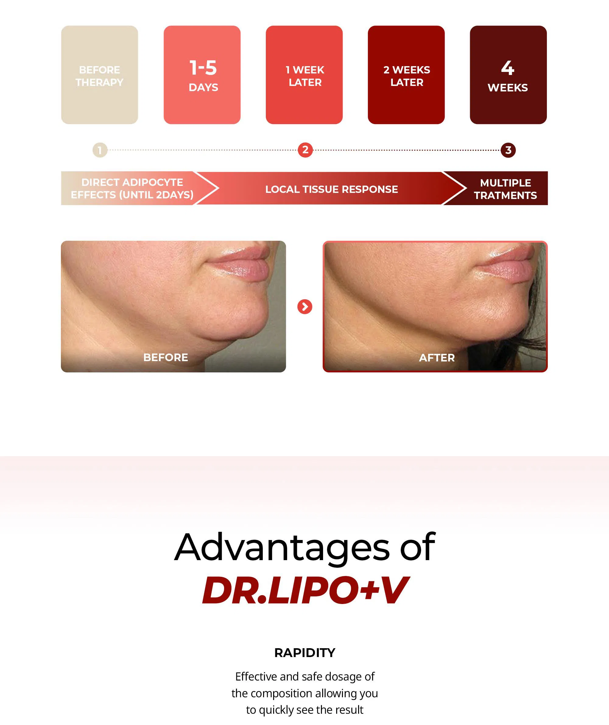 Dr. Lipo+ V (Face) · product information