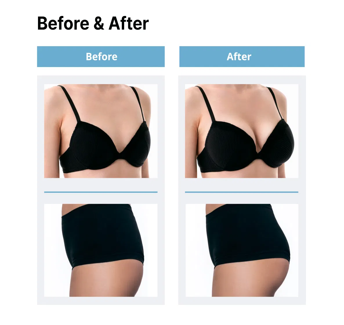Venu Fill Body Filler Soft Type · product information