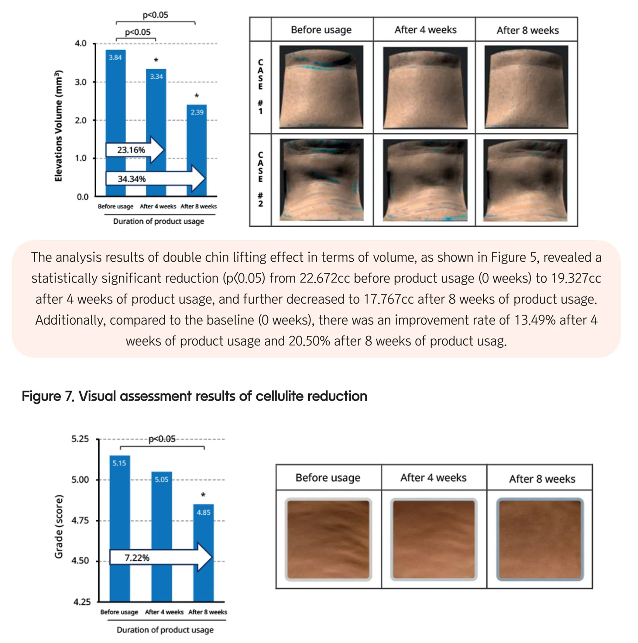 Lipo Shrinker (1 vial) · product information