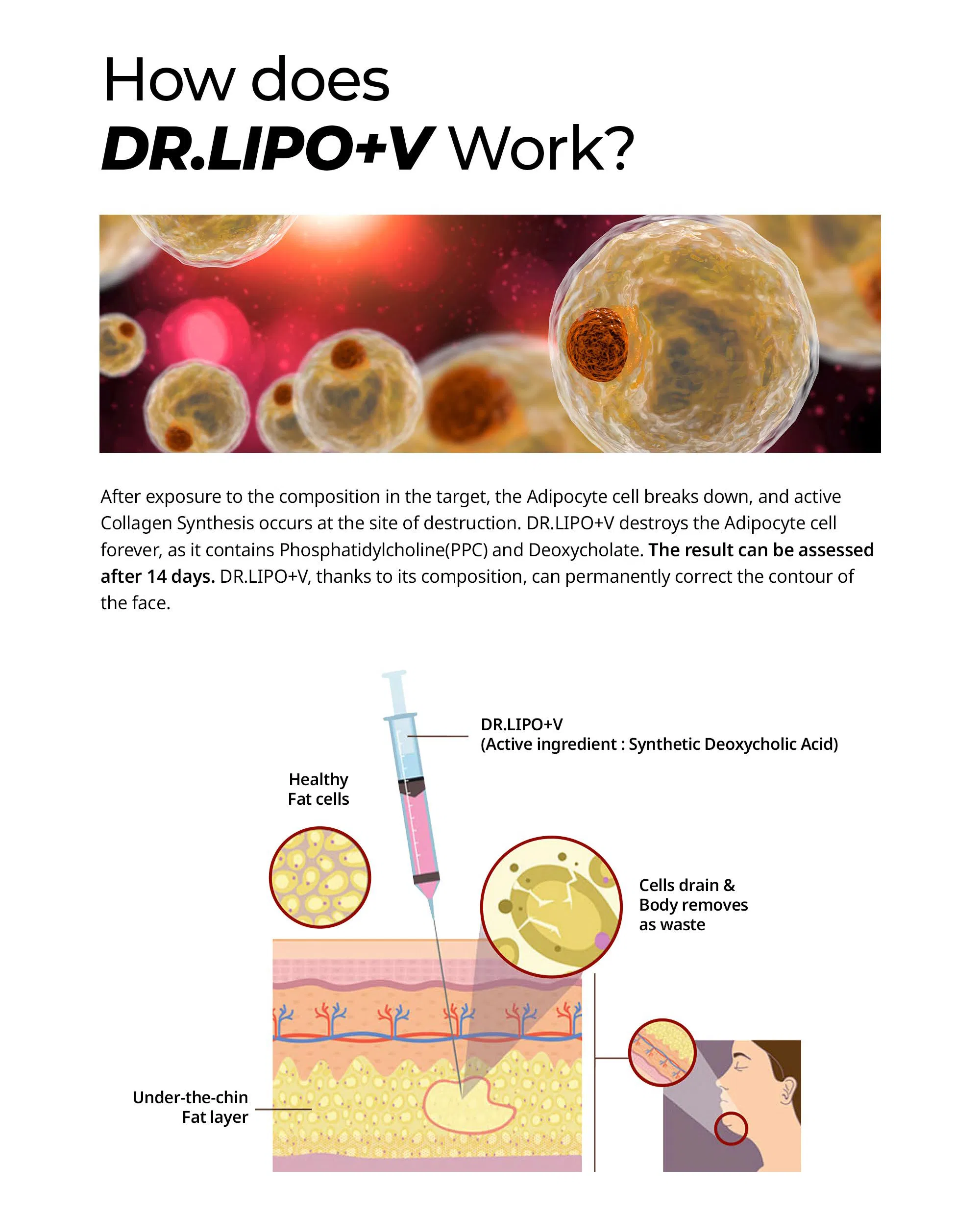 Dr. Lipo+ V (Face) · product information