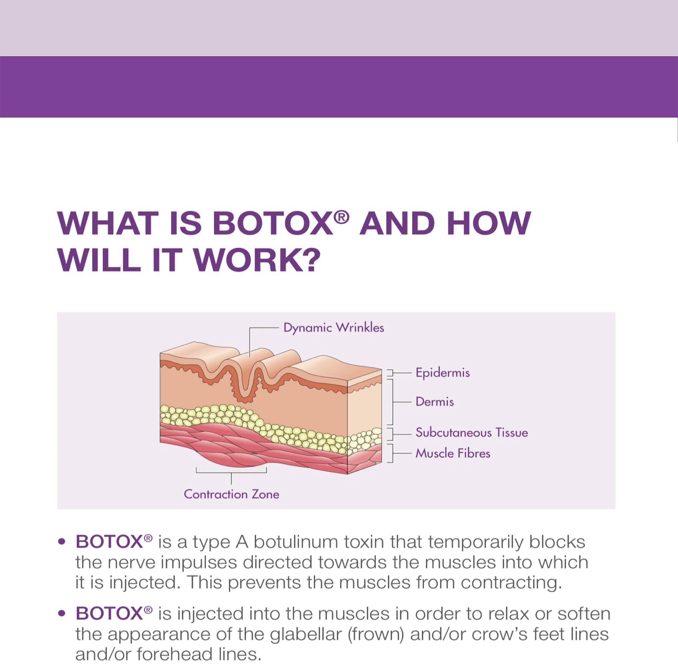 Botox 50 unidades · información del producto