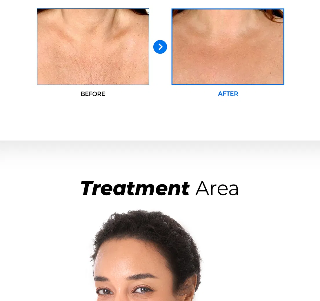 Hyalace · product information