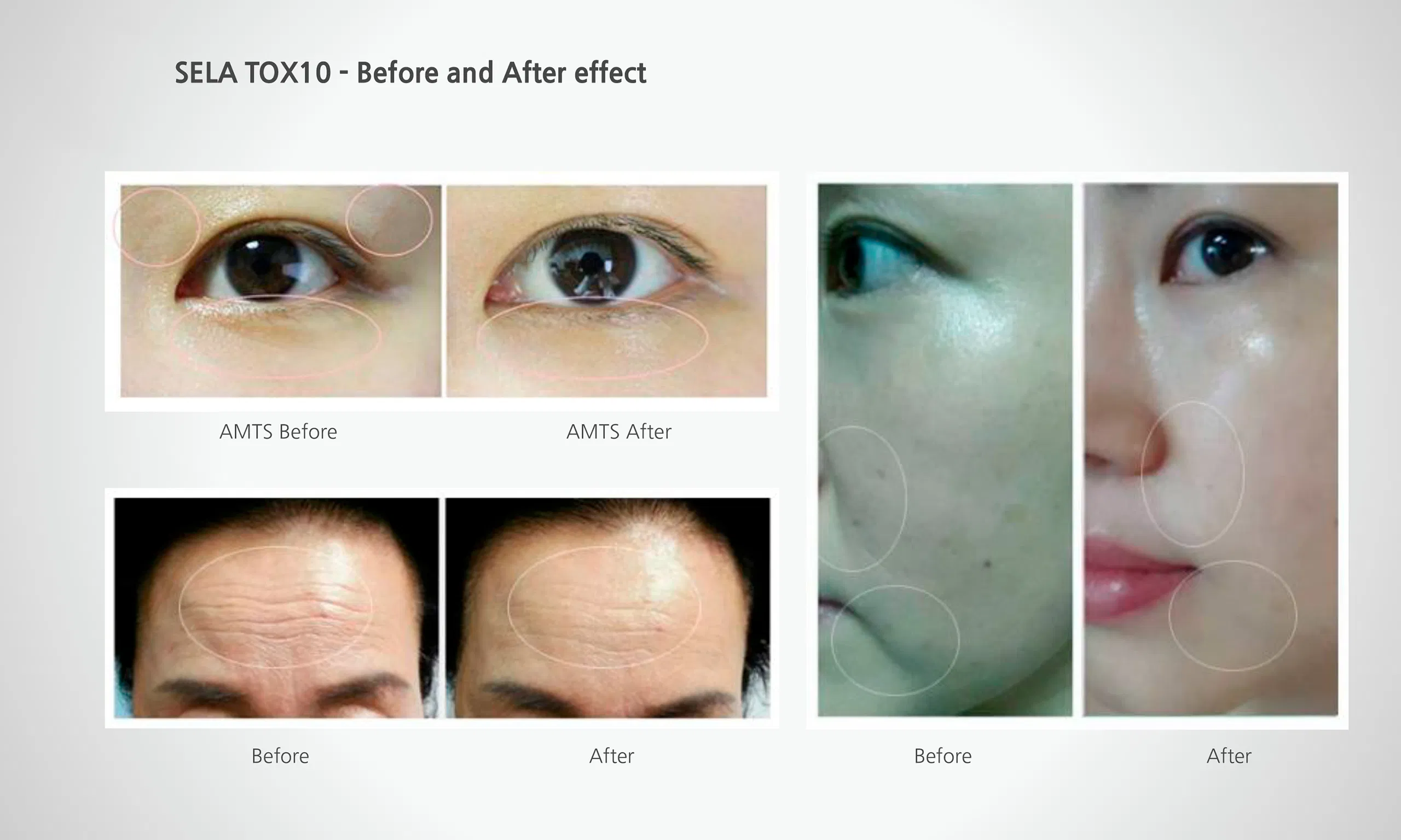 Sela Tox 10 · product information
