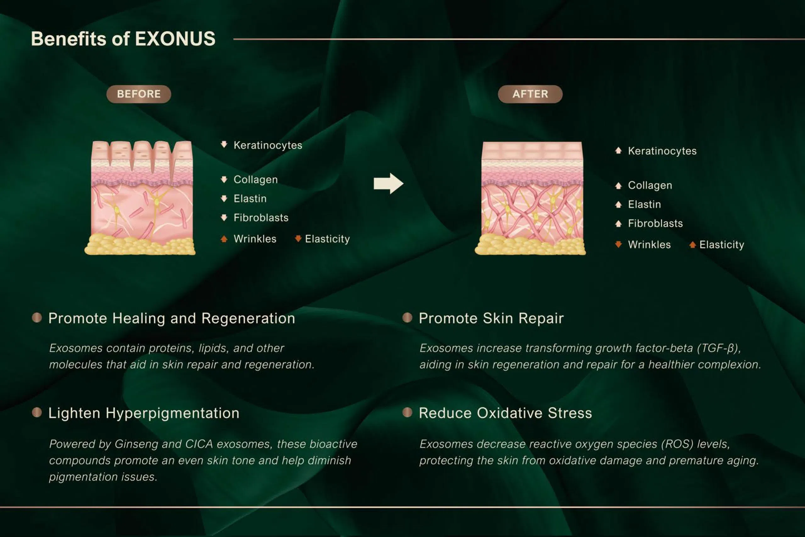 Exonus · product information