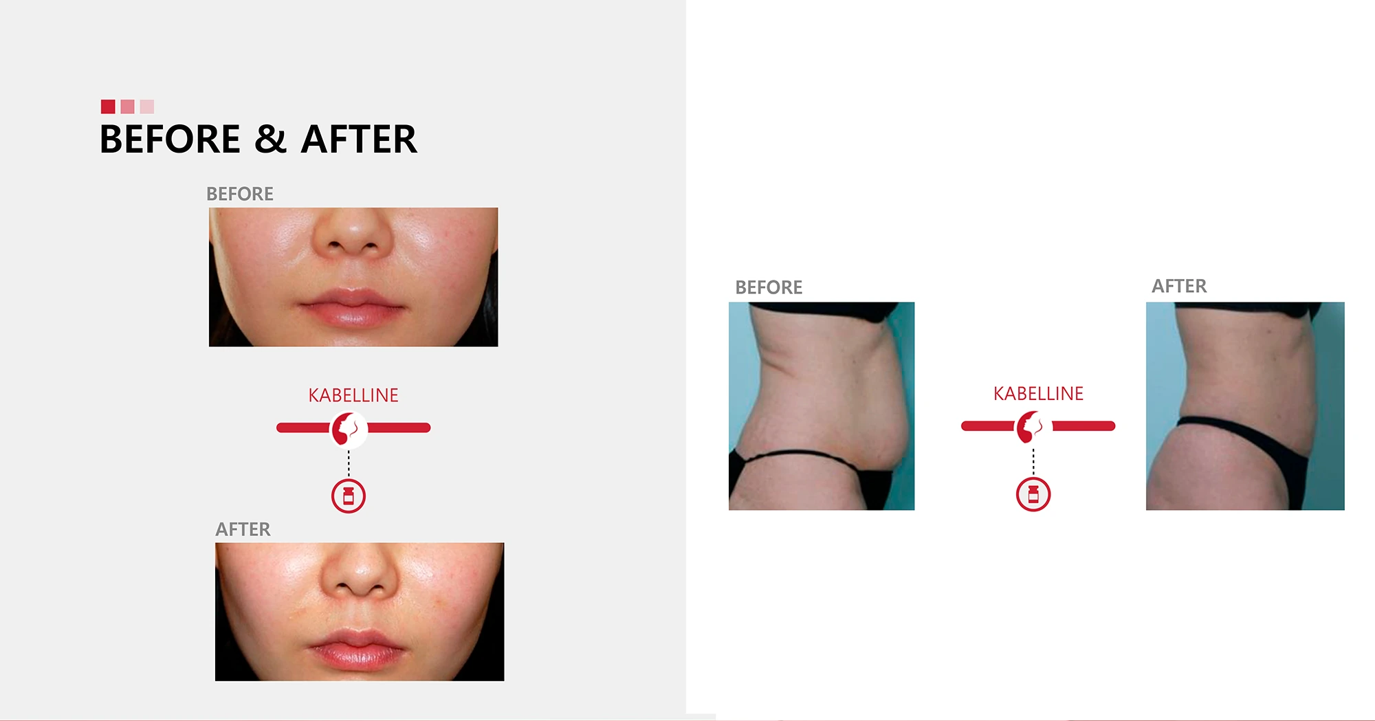 Kabelline · product information