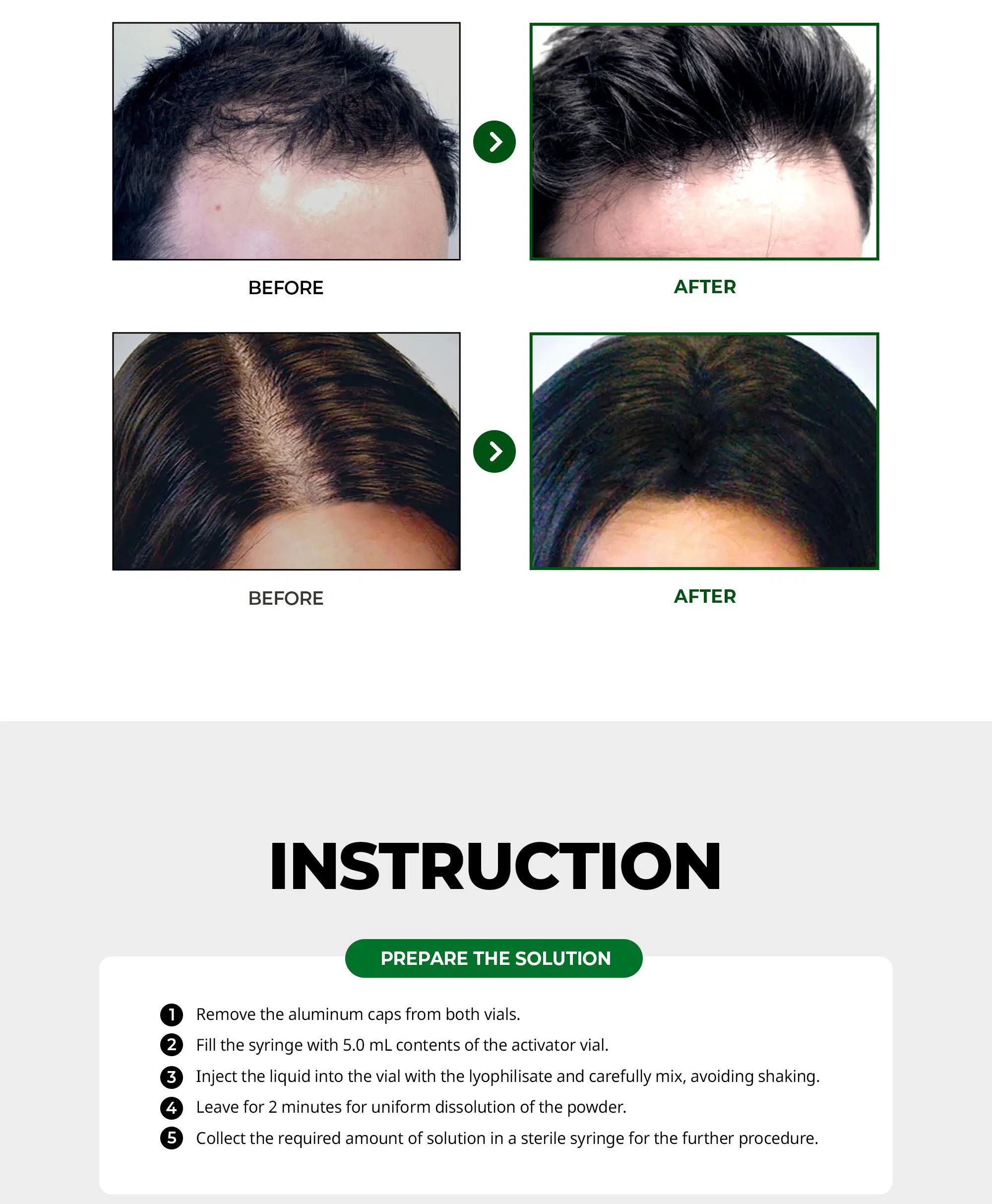 Hanheal Exosome Hair Filler · información del producto